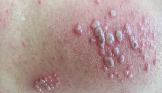 primal queen side effects
