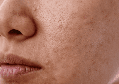 face dull