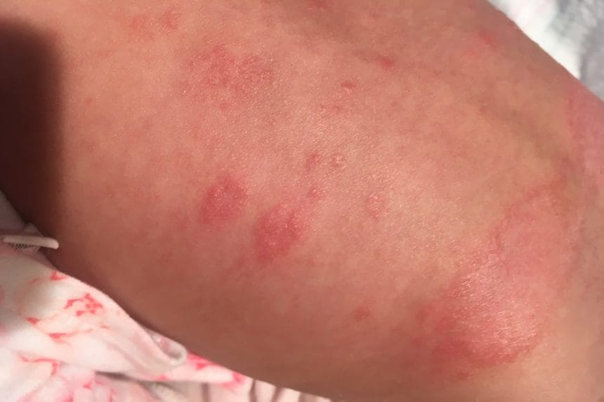 GlucoTrim Scam