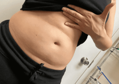 weightloss