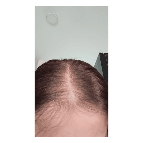 Rennora Hair Growth Serum Scam 