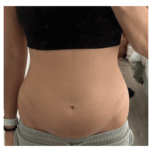 Bladder Shield Scam