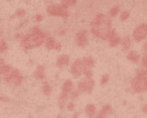 red pigments 
