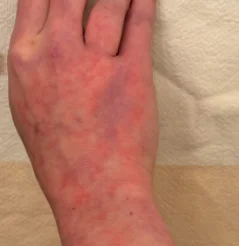 red pigments on hand