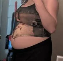 bloating